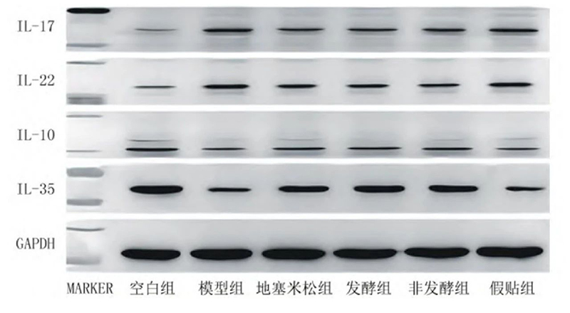 空白組和支氣管哮喘各組大鼠肺組織中IL－17、IL－22、IL－10、IL－35蛋白表達電泳圖